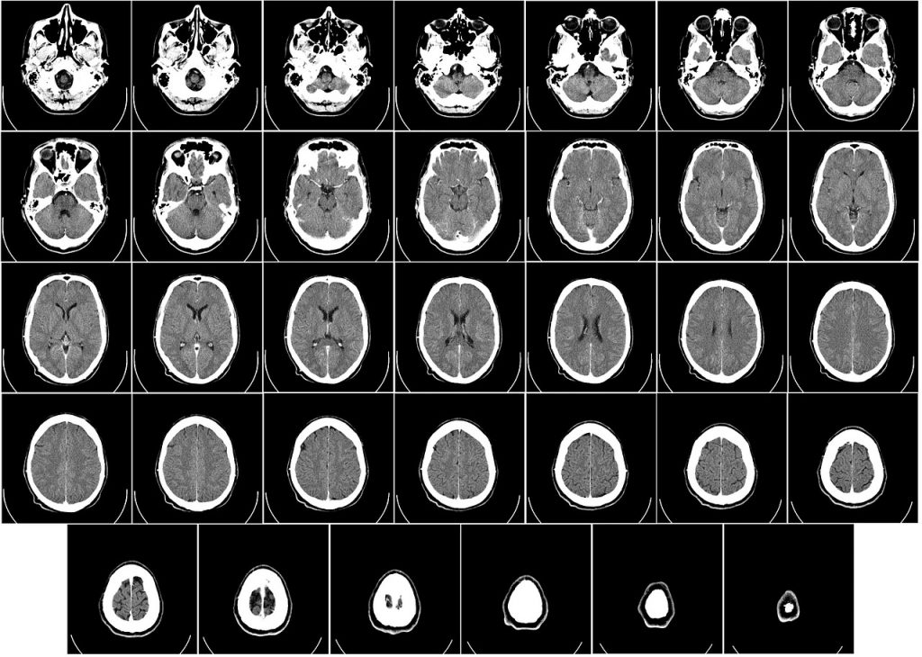 computer tomography, ct, radiography-62942.jpg